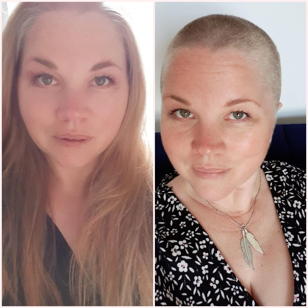 A woman before and after a head shave